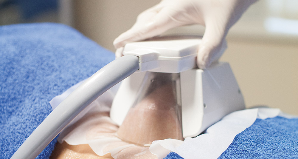 How Fat Freezing and HIFU Work Together? 2 Multiple Areas in One Session HIFU and Fat Freezing Derbyshire