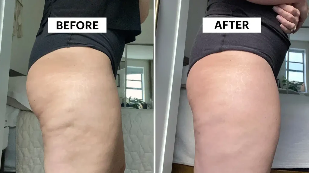 Do Toning Exercise Derbyshire Really Tackle Cellulite?