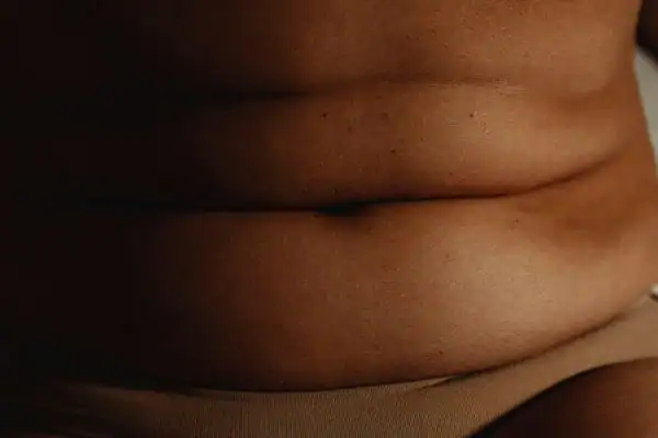 The Hidden Connection: How Stress Shapes Your Fitness and Body Composition 3 image of what stress can do on the stomach area and how Lipo 360 Derbyshire can help to change your body shape.