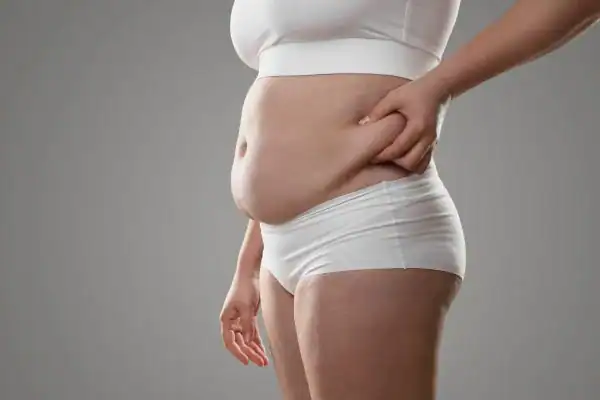 Image of stress belly Derbyshire How Lipo 360 can help manage your symptoms